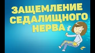 Упражнения при защемлении седалищного нерва | ЛФК