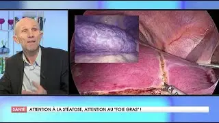 LA STÉATOSE HÉPATIQUE C'EST QUOI ?