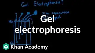 Gel electrophoresis