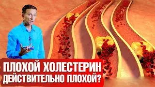 Какой холестерин - плохой? 🤷‍♀️ ЛПНП - не плохой?! Как снизить холестерин