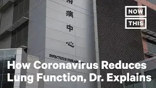 COVID-19: Hong Kong Doctor on Lung Function in Recovered Patients | NowThis