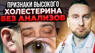 Как определить повышенный холестерин по глазам и ... Кардиолог @Доктор Утин