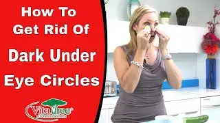 How To Get Rid of Dark Under Eye Circles : Natural Home Remedies : Beauty Tips - Episode 155