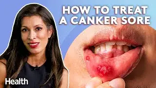 Periodontist Talks How To Treat Canker Sores, Mouth Disease, and Dry Socket | Ask An Expert | Health